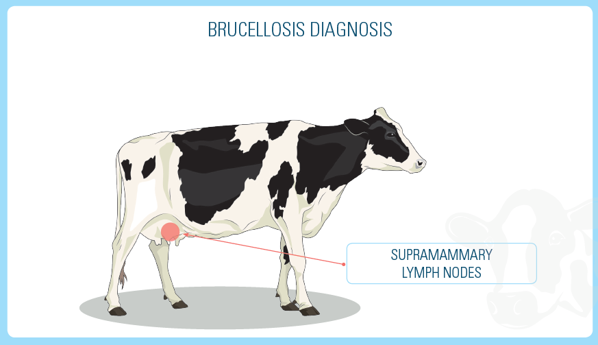 brucellosis diagnosis