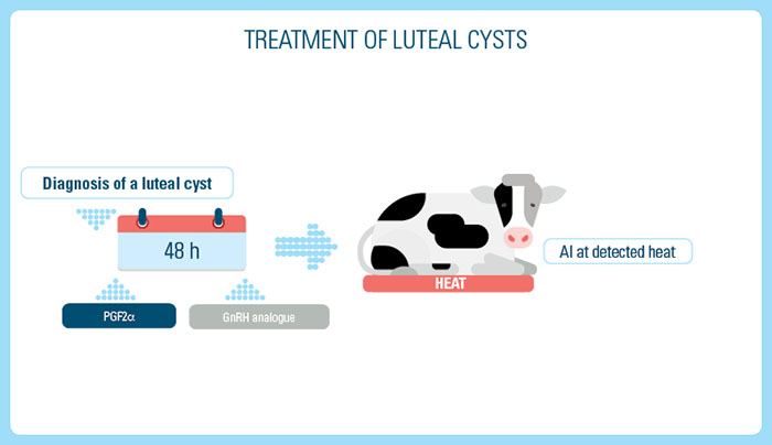 Treatment of Luteal cysts
